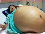 Tato žena ve svých 42 letech porodila 11 dětí. Doktoři jsou v šoku!