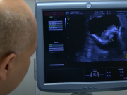 Lékař si na miminku během ultrazvuku všiml PODIVNÉHO jevu: Brzy zjistili, že v ní ŽIJE něco neuvěřitelného